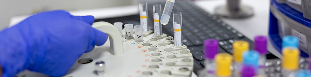 Hematologist analyzing medical samples at the laboratory.