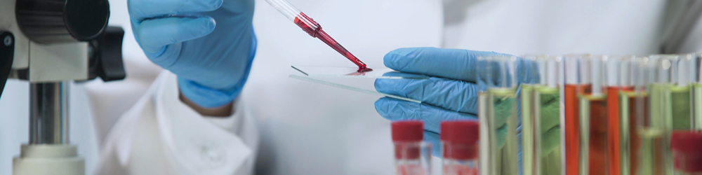 Lab assistant doing microbiological analysis.